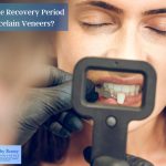 What is the recovery period for porcelain veneers?